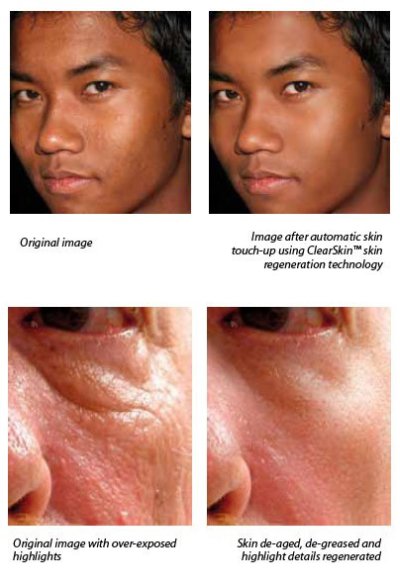 nextgenskinenhancement01.jpg