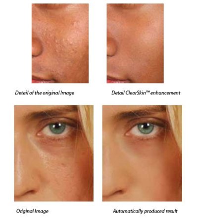 nextgenskinenhancement02.jpg